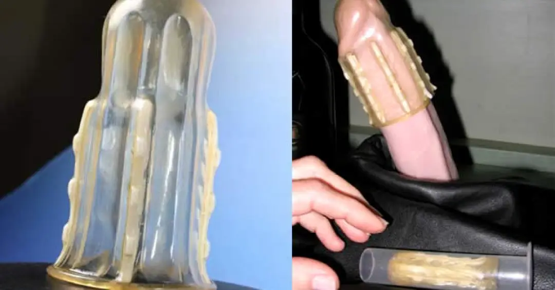 Mulher Sul-Africana inventou dispositivo anti-estupro que só sai com cirurgia