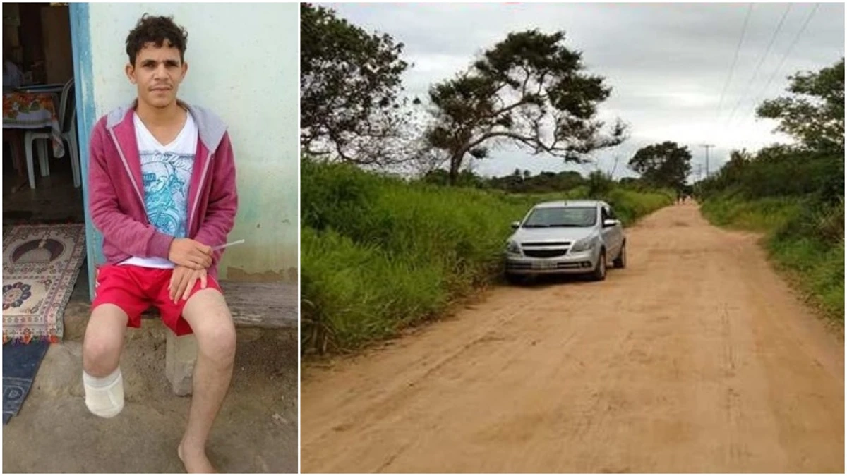 Homem  corta o próprio pé para tentar receber seguro de R$ 1,5 milhão.