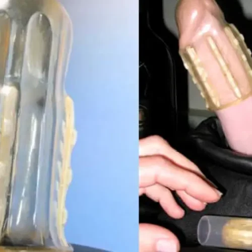 Mulher Sul-Africana inventou dispositivo anti-estupro que só sai com cirurgia