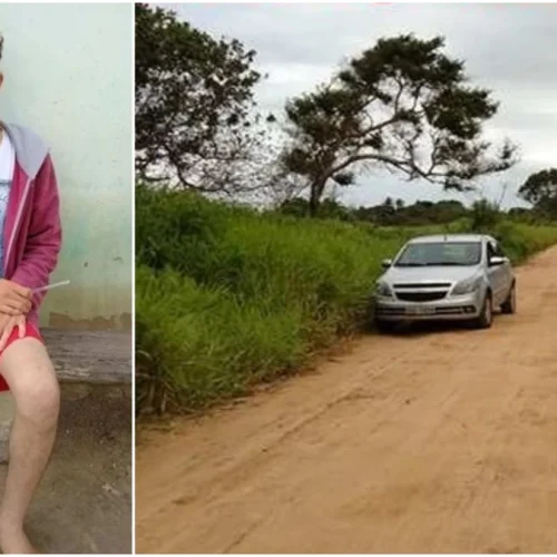 Homem  corta o próprio pé para tentar receber seguro de R$ 1,5 milhão.