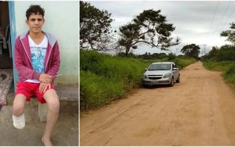 Homem  corta o próprio pé para tentar receber seguro de R$ 1,5 milhão.